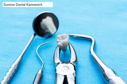 Sunrise Dental Kennewick