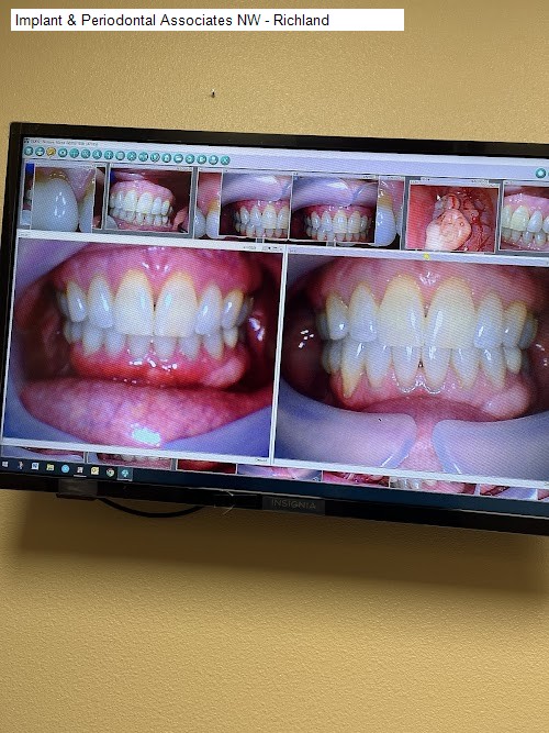 Implant & Periodontal Associates NW - Richland