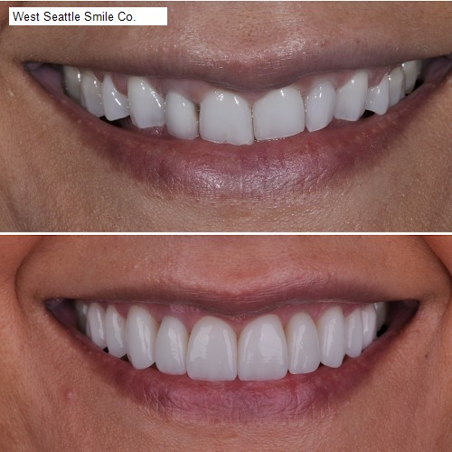 West Seattle Smile Co.