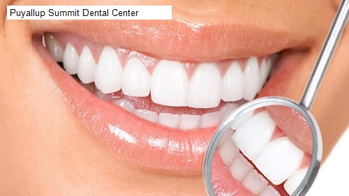 Puyallup Summit Dental Center