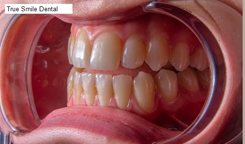 True Smile Dental