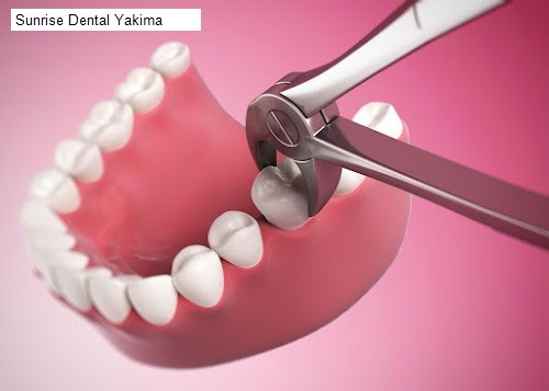 Sunrise Dental Yakima